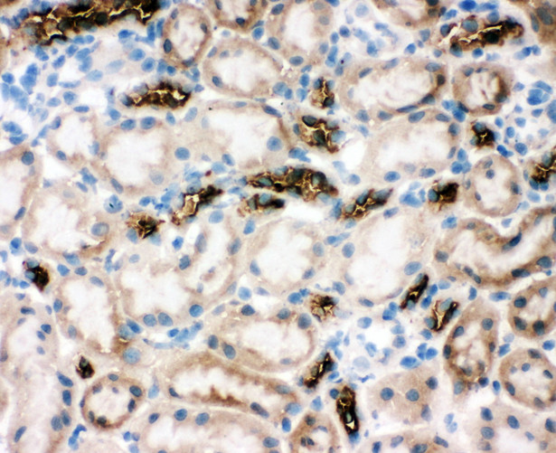 SLC12A1 / NKCC2 Antibody - SLC12A1 / NKCC2 antibody. IHC(F): Rat Kidney Tissue.