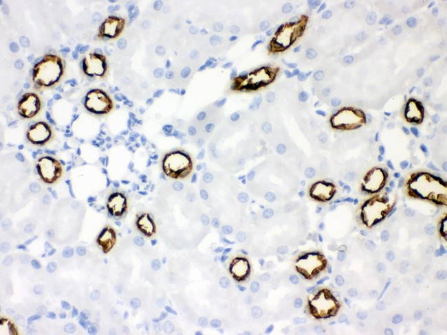 SLC12A1 / NKCC2 Antibody - SLC12A1 antibody IHC-paraffin: Rat Kidney Tissue.
