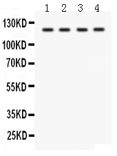 SLC12A1 / NKCC2 Antibody - anti-SLC12A1 Picoband antibody Western blotting All lanes: Anti SLC12A1 at 0.5ug/ml Lane 1: HELA Whole Cell Lysate at 40ugLane 2: JURKAT Whole Cell Lysate at 40ugLane 3: SKOV Whole Cell Lysate at 40ugLane 4: Mouse Kidney Tissue Lysate at 50ugPredicted bind size: 121KD Observed bind size: 121KD