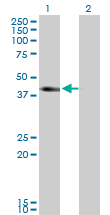 SLC12A1 / NKCC2 Antibody - Western Blot analysis of SLC12A1 expression in transfected 293T cell line by SLC12A1 monoclonal antibody (M03), clone 4H4.Lane 1: SLC12A1 transfected lysate(46.5 KDa).Lane 2: Non-transfected lysate.