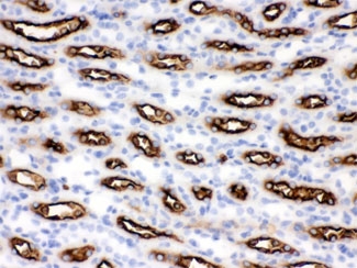 SLC12A1 / NKCC2 Antibody