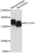 SLC12A1 / NKCC2 Antibody - Western blot analysis of extracts of various cell lines, using SLC12A1 antibody at 1:1000 dilution. The secondary antibody used was an HRP Goat Anti-Rabbit IgG (H+L) at 1:10000 dilution. Lysates were loaded 25ug per lane and 3% nonfat dry milk in TBST was used for blocking. An ECL Kit was used for detection and the exposure time was 90s.