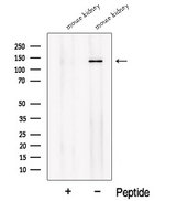 SLC12A1 / NKCC2 Antibody - Western blot analysis of extracts of 3T3 cells using NKCC2 antibody. The lane on the left was treated with blocking peptide.