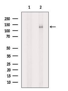 SLC12A1 / NKCC2 Antibody