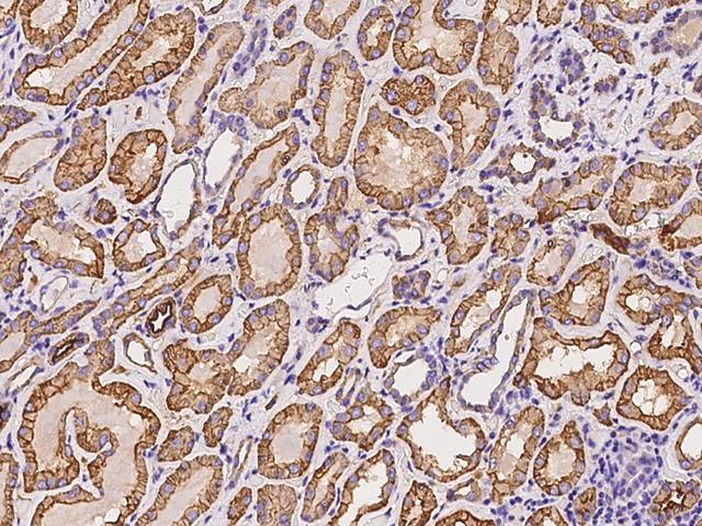 SLC12A1 / NKCC2 Antibody - Immunochemical staining of human SLC12A1 in human kidney with rabbit polyclonal antibody at 1:300 dilution, formalin-fixed paraffin embedded sections.