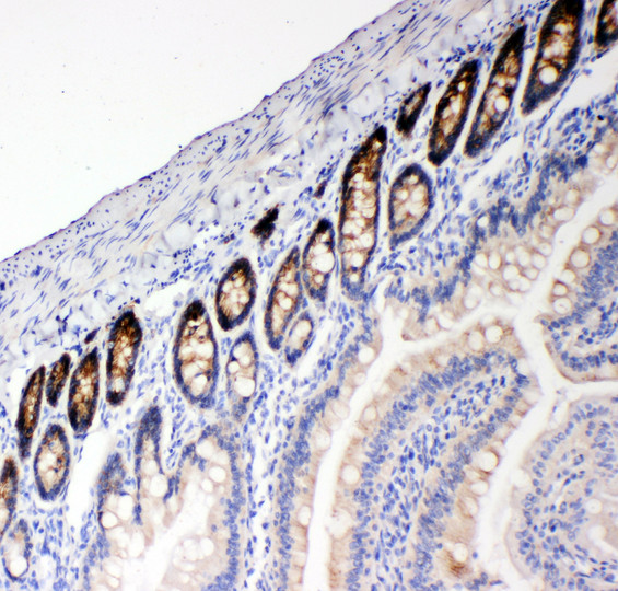 SLC12A2 / NKCC1 Antibody - SLC12A2 / NKCC1 antibody. IHC(P): Rat Intestine Tissue.