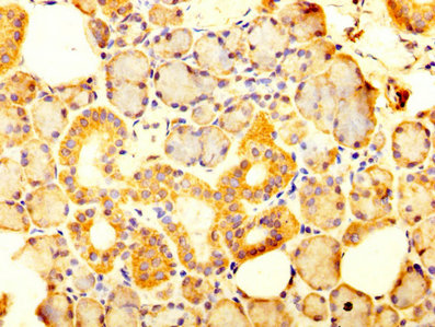 SLC12A2 / NKCC1 Antibody - Immunohistochemistry image at a dilution of 1:300 and staining in paraffin-embedded human salivary gland tissue performed on a Leica BondTM system. After dewaxing and hydration, antigen retrieval was mediated by high pressure in a citrate buffer (pH 6.0) . Section was blocked with 10% normal goat serum 30min at RT. Then primary antibody (1% BSA) was incubated at 4 °C overnight. The primary is detected by a biotinylated secondary antibody and visualized using an HRP conjugated SP system.