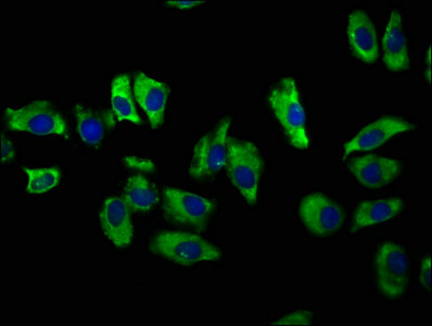 SLC12A2 / NKCC1 Antibody - Immunofluorescence staining of A549 cells with SLC12A2 Antibody at 1:100, counter-stained with DAPI. The cells were fixed in 4% formaldehyde, permeabilized using 0.2% Triton X-100 and blocked in 10% normal Goat Serum. The cells were then incubated with the antibody overnight at 4°C. The secondary antibody was Alexa Fluor 488-congugated AffiniPure Goat Anti-Rabbit IgG(H+L).