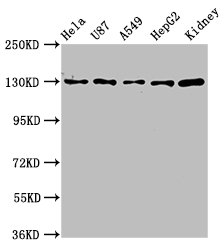 SLC12A2 / NKCC1 Antibody - Western Blot Positive WB detected in: Hela whole cell lysate, U87 whole cell lysate, A549 whole cell lysate, HepG2 whole cell lysate, Mouse kidney tissue All lanes: SLC12A2 antibody at 6.8µg/ml Secondary Goat polyclonal to rabbit IgG at 1/50000 dilution Predicted band size: 132, 130 kDa Observed band size: 132 kDa