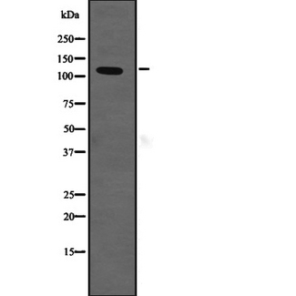 SLC12A2 / NKCC1 Antibody - Western blot analysis of SLC12A2 expression in HEK293 cells. The lane on the left is treated with the antigen-specific peptide.