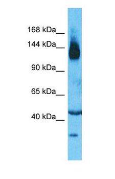 SLC12A2 / NKCC1 Antibody - Western blot of SLC12A2 Antibody with human Thymus Tumor lysate.  This image was taken for the unconjugated form of this product. Other forms have not been tested.