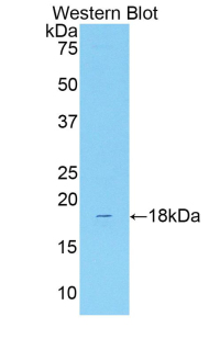 SLC12A3 / TSC Antibody - Western blot of recombinant SLC12A3 / TSC.  This image was taken for the unconjugated form of this product. Other forms have not been tested.