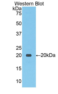 SLC12A3 / TSC Antibody - Western blot of recombinant SLC12A3 / TSC.