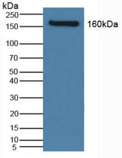 SLC12A3 / TSC Antibody - Western Blot; Sample: Human Serum.