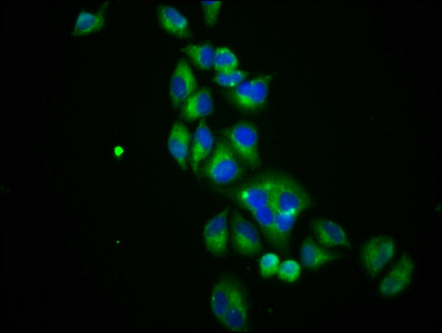 SLC12A3 / TSC Antibody - Immunofluorescence staining of Hela cells diluted at 1:100, counter-stained with DAPI. The cells were fixed in 4% formaldehyde, permeabilized using 0.2% Triton X-100 and blocked in 10% normal Goat Serum. The cells were then incubated with the antibody overnight at 4°C.The Secondary antibody was Alexa Fluor 488-congugated AffiniPure Goat Anti-Rabbit IgG (H+L).
