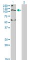 SLC12A4 / KCC1 Antibody - Western Blot analysis of SLC12A4 expression in transfected 293T cell line by SLC12A4 monoclonal antibody (M01), clone 1H6.Lane 1: SLC12A4 transfected lysate(120.6 KDa).Lane 2: Non-transfected lysate.