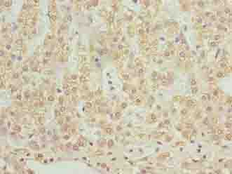 SLC12A4 / KCC1 Antibody - Immunohistochemistry of paraffin-embedded human adrenal gland tissue using antibody at dilution of 1:100.