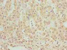 SLC12A4 / KCC1 Antibody - Immunohistochemistry of paraffin-embedded human adrenal gland tissue using antibody at dilution of 1:100.