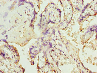 SLC12A4 / KCC1 Antibody - Immunohistochemistry of paraffin-embedded human placenta tissue using SLC12A4 Antibody at dilution of 1:100