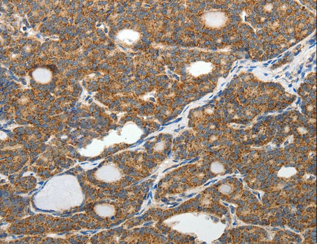 SLC12A4 / KCC1 Antibody - Immunohistochemistry of paraffin-embedded Human brain using SLC12A4 Polyclonal Antibody at dilution of 1:30.