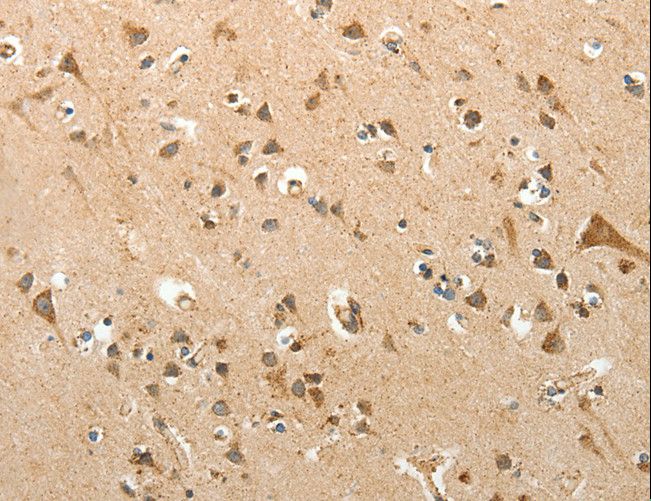 SLC12A4 / KCC1 Antibody - Immunohistochemistry of paraffin-embedded Human brain using SLC12A4 Polyclonal Antibody at dilution of 1:30.