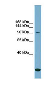 SLC12A4 / KCC1 Antibody - SLC12A4 antibody Western blot of PANC1 cell lysate. This image was taken for the unconjugated form of this product. Other forms have not been tested.