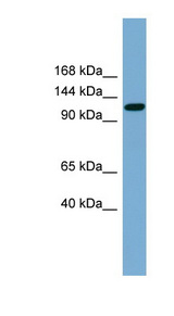 SLC12A5 / KCC2 Antibody - SLC12A5 / KCC2 antibody Western blot of Fetal Spleen lysate. This image was taken for the unconjugated form of this product. Other forms have not been tested.