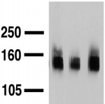 SLC12A5 / KCC2 Antibody - Western blot analysis of KCC2 in adult rat brain.