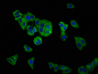 SLC12A5 / KCC2 Antibody - Immunofluorescence staining of HepG2 cells at a dilution of 1:166, counter-stained with DAPI. The cells were fixed in 4% formaldehyde, permeabilized using 0.2% Triton X-100 and blocked in 10% normal Goat Serum. The cells were then incubated with the antibody overnight at 4 °C.The secondary antibody was Alexa Fluor 488-congugated AffiniPure Goat Anti-Rabbit IgG (H+L) .
