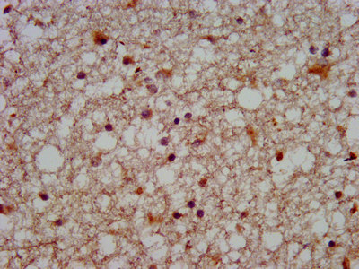 SLC12A5 / KCC2 Antibody - Immunohistochemistry image at a dilution of 1:500 and staining in paraffin-embedded human brain tissue performed on a Leica BondTM system. After dewaxing and hydration, antigen retrieval was mediated by high pressure in a citrate buffer (pH 6.0) . Section was blocked with 10% normal goat serum 30min at RT. Then primary antibody (1% BSA) was incubated at 4 °C overnight. The primary is detected by a biotinylated secondary antibody and visualized using an HRP conjugated SP system.