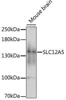SLC12A5 / KCC2 Antibody - Western blot analysis of extracts of mouse brain, using SLC12A5 antibody at 1:1000 dilution. The secondary antibody used was an HRP Goat Anti-Rabbit IgG (H+L) at 1:10000 dilution. Lysates were loaded 25ug per lane and 3% nonfat dry milk in TBST was used for blocking. An ECL Kit was used for detection and the exposure time was 60s.