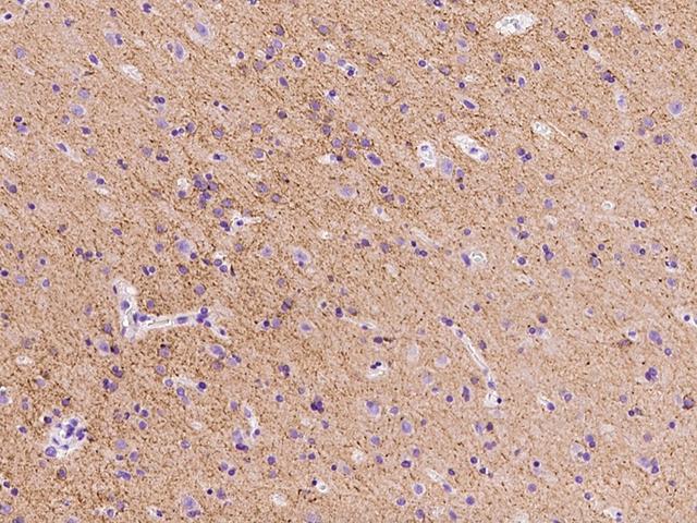 SLC12A5 / KCC2 Antibody - Immunochemical staining of human SLC12A5 in human brain with rabbit polyclonal antibody at 1:100 dilution, formalin-fixed paraffin embedded sections.