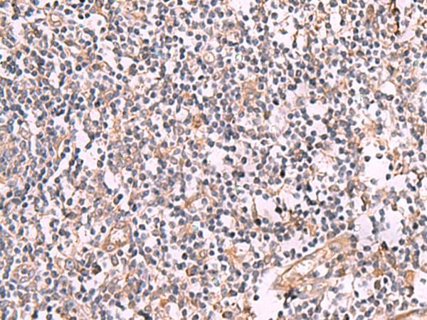 SLC12A5 / KCC2 Antibody - Immunohistochemistry of paraffin-embedded Human tonsil tissue  using SLC12A5 Polyclonal Antibody at dilution of 1:50(×200)