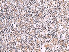SLC12A5 / KCC2 Antibody - Immunohistochemistry of paraffin-embedded Human tonsil tissue  using SLC12A5 Polyclonal Antibody at dilution of 1:50(×200)