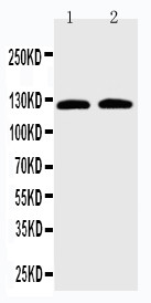 SLC12A6 / KCC3 Antibody - WB of SLC12A6 / KCC3 antibody. Lane 1: HELA Cell Lysate. Lane 2: HUT102 Cell Lysate.
