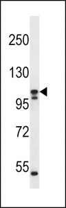 SLC12A6 / KCC3 Antibody - SLC12A6 Antibody western blot of ZR-75-1 cell line lysates (35 ug/lane). The SLC12A6 antibody detected the SLC12A6 protein (arrow).