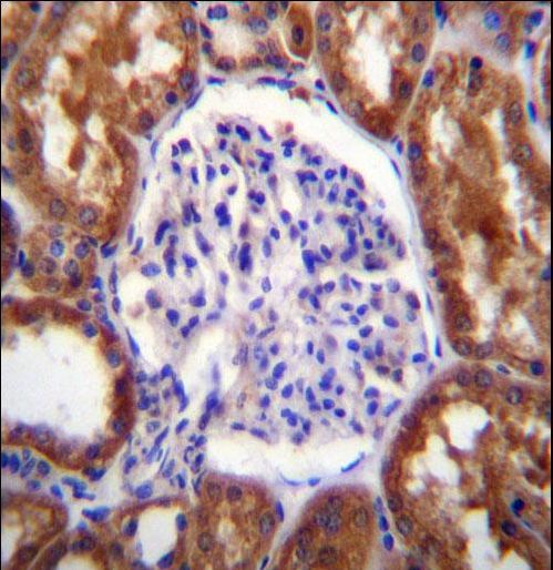 SLC12A6 / KCC3 Antibody - SLC12A6 Antibody immunohistochemistry of formalin-fixed and paraffin-embedded human kidney tissue followed by peroxidase-conjugated secondary antibody and DAB staining.