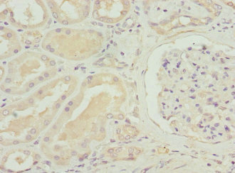 SLC12A6 / KCC3 Antibody - Immunohistochemistry of paraffin-embedded human kidney tissue at dilution 1:100