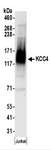SLC12A7 / KCC4 Antibody - Detection of Human KCC4 by Western Blot. Samples: Whole cell lysate (50 ug) prepared using NETN buffer from Jurkat cells. Antibodies: Affinity purified rabbit anti-KCC4 antibody used for WB at 0.4 ug/ml. Detection: Chemiluminescence with an exposure time of 30 seconds.