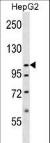 SLC12A7 / KCC4 Antibody - SLC12A7 Antibody western blot of HepG2 cell line lysates (35 ug/lane). The SLC12A7 antibody detected the SLC12A7 protein (arrow).