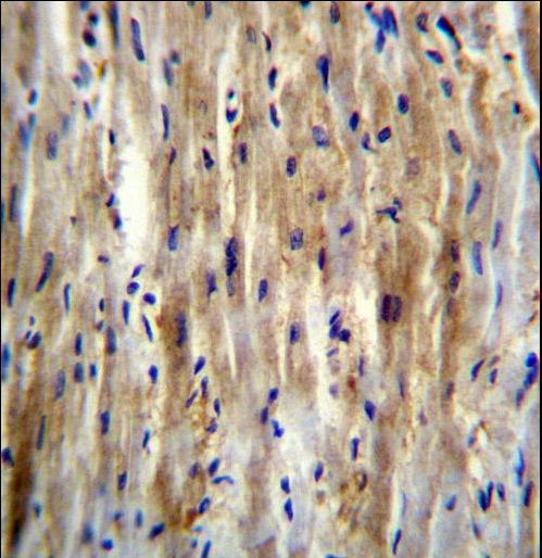 SLC12A7 / KCC4 Antibody - SLC12A7 Antibody immunohistochemistry of formalin-fixed and paraffin-embedded human heart tissue followed by peroxidase-conjugated secondary antibody and DAB staining.
