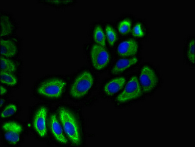 SLC12A7 / KCC4 Antibody - Immunofluorescent analysis of A549 cells diluted at 1:100 and Alexa Fluor 488-congugated AffiniPure Goat Anti-Rabbit IgG(H+L)