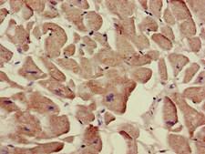 SLC12A7 / KCC4 Antibody - Immunohistochemistry of paraffin-embedded human heart tissue at dilution of 1:100