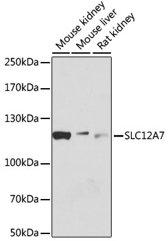 SLC12A7 / KCC4 Antibody - Western blot analysis of extracts of various cell lines, using SLC12A7 antibody at 1:1000 dilution. The secondary antibody used was an HRP Goat Anti-Rabbit IgG (H+L) at 1:10000 dilution. Lysates were loaded 25ug per lane and 3% nonfat dry milk in TBST was used for blocking. An ECL Kit was used for detection and the exposure time was 30s.