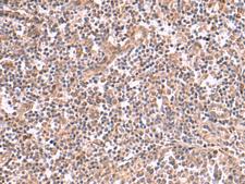 SLC12A7 / KCC4 Antibody - Immunohistochemistry of paraffin-embedded Human tonsil tissue  using SLC12A7 Polyclonal Antibody at dilution of 1:50(×200)