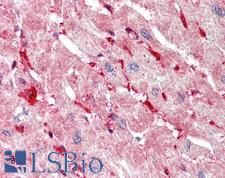 SLC13A1 Antibody - Anti-SLC13A1 antibody IHC staining of human heart. Immunohistochemistry of formalin-fixed, paraffin-embedded tissue after heat-induced antigen retrieval. Antibody concentration 10 ug/ml.  This image was taken for the unconjugated form of this product. Other forms have not been tested.