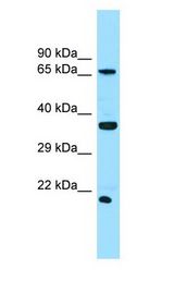 SLC13A1 Antibody - SLC13A1 antibody Western Blot of THP-1.  This image was taken for the unconjugated form of this product. Other forms have not been tested.