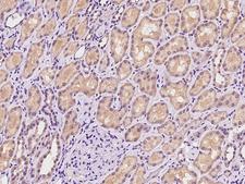 SLC13A1 Antibody - Immunochemical staining of human SLC13A1 in human kidney with rabbit polyclonal antibody at 1:100 dilution, formalin-fixed paraffin embedded sections.