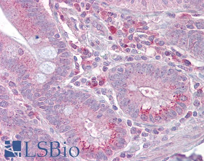 SLC13A2 / NaCT Antibody - Anti-SLC13A2 antibody IHC of human small intestine. Immunohistochemistry of formalin-fixed, paraffin-embedded tissue after heat-induced antigen retrieval. Antibody concentration 5 ug/ml.  This image was taken for the unconjugated form of this product. Other forms have not been tested.