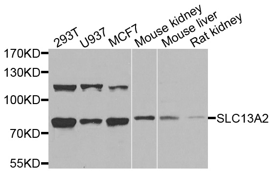 SLC13A2 / NaCT Antibody - Western blot analysis of extracts of various cells.